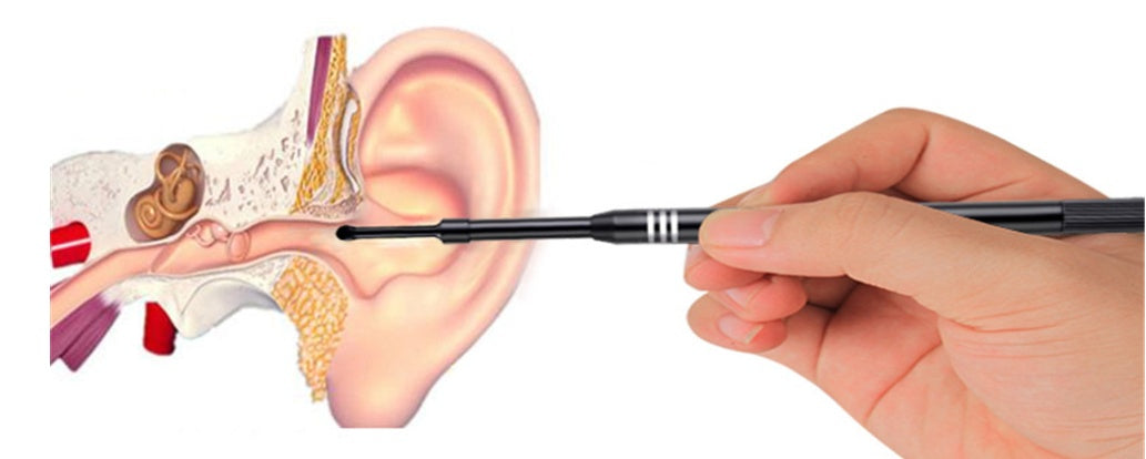 Endoscope Ear Pick - iztia