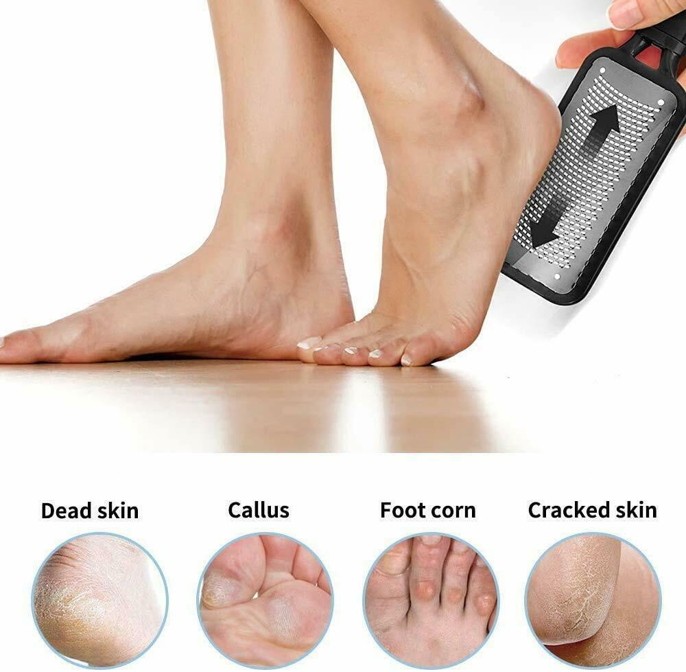 Foot Rasp File Callus Remover Pedicure Tool Dead Hard Skin Scraper Scrubber Tool - iztia