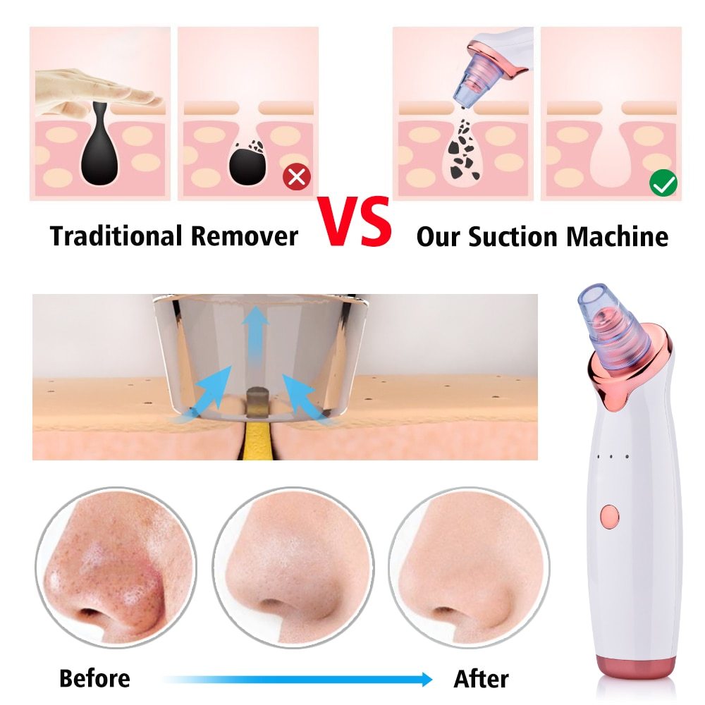 Blackhead Instrument Electric Suction Facial Washing Instrument Beauty Acne Cleaning Blackhead Suction Instrument - iztia