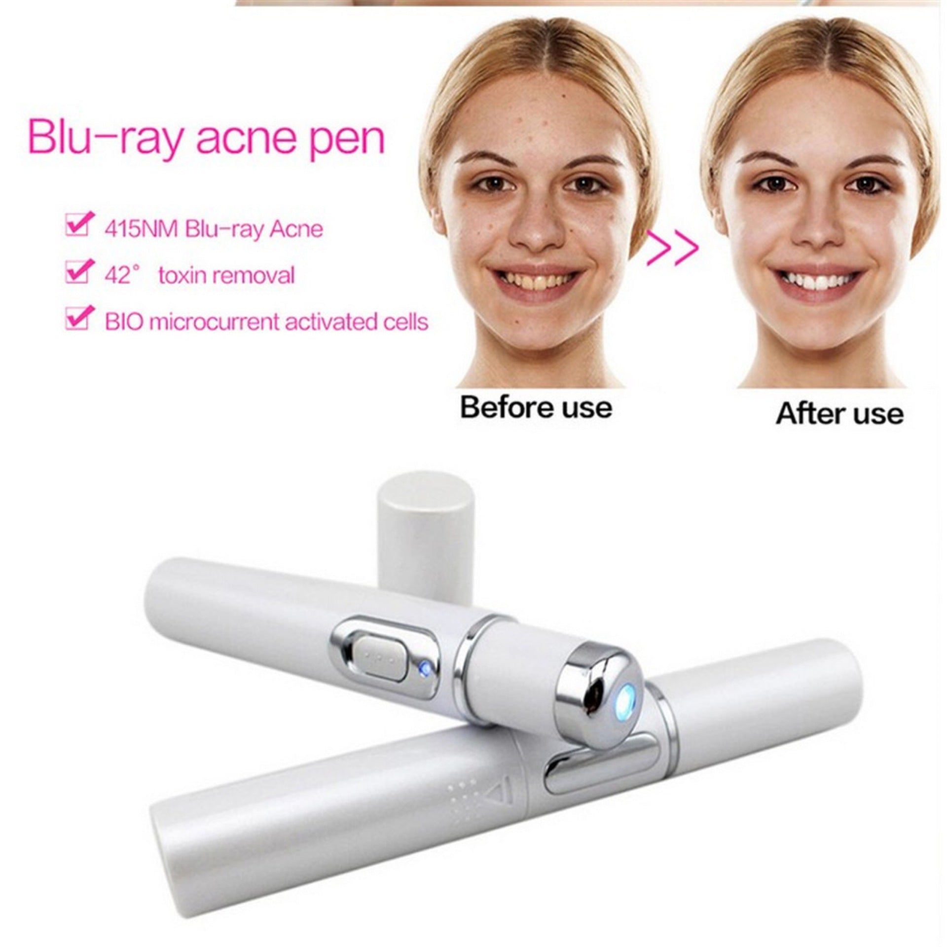 Blue Light Therapy Acne Laser Pen Soft Scar Wrinkle Removal Treatment Device Skin Care Beauty Equipment - iztia