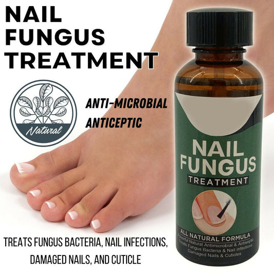 Anti Fungal Nail Treatment Nail Finger Toe Fungus Onychomycosis Remover - iztia