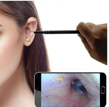Endoscope Ear Pick - iztia