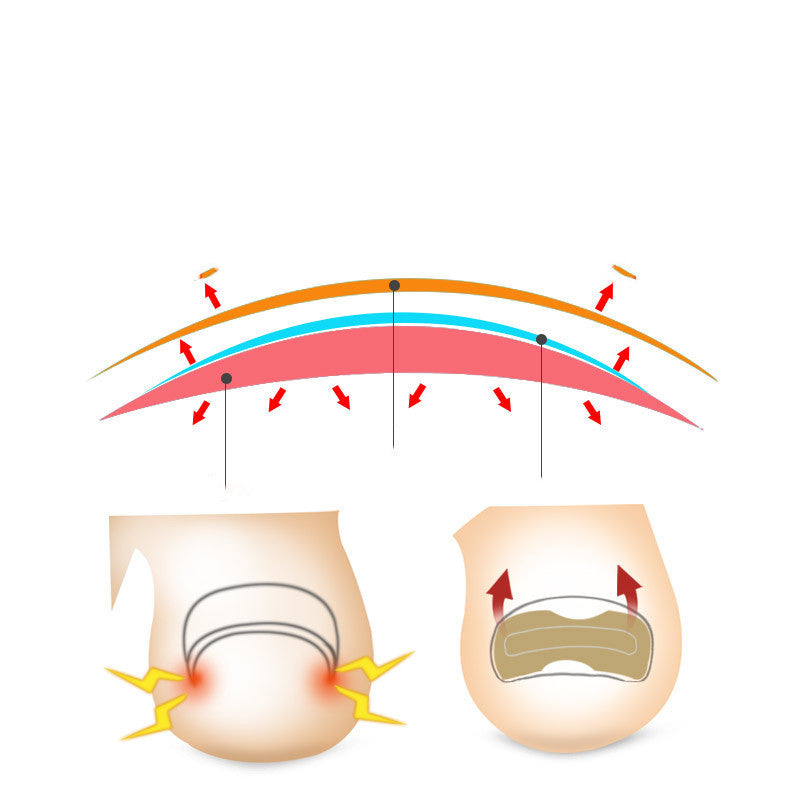 Glue-free orthopaedic nail fixation device - iztia