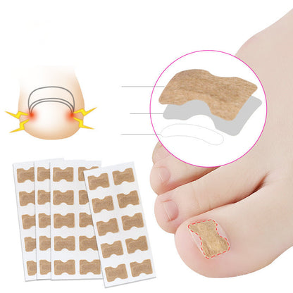 Glue-free orthopaedic nail fixation device - iztia