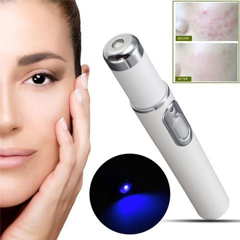 Blue Light Therapy Acne Laser Pen Soft Scar Wrinkle Removal Treatment Device Skin Care Beauty Equipment - iztia