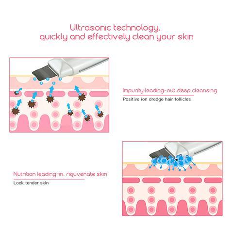 Ultrasonic Skin Scrubber Face Cleanser Blackhead Acne Removal Facial Spa Vibration Massager Ultrasound Peeling Clean Machine 394 - iztia