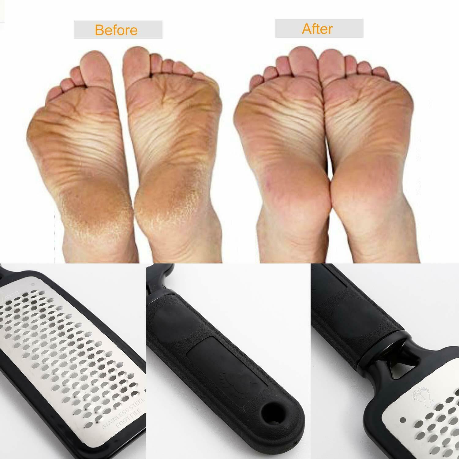 Foot Rasp File Callus Remover Pedicure Tool Dead Hard Skin Scraper Scrubber Tool - iztia