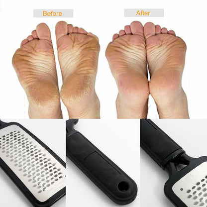 Foot Rasp File Callus Remover Pedicure Tool Dead Hard Skin Scraper Scrubber Tool - iztia