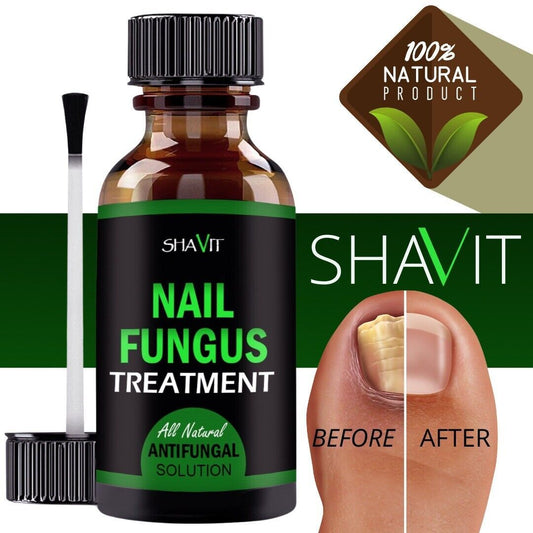 ANTI FUNGAL TREATMENT EXTRA STRENGTH TOENAIL FUNGUS ATHLETES FOOT FUNGI NAIL - iztia