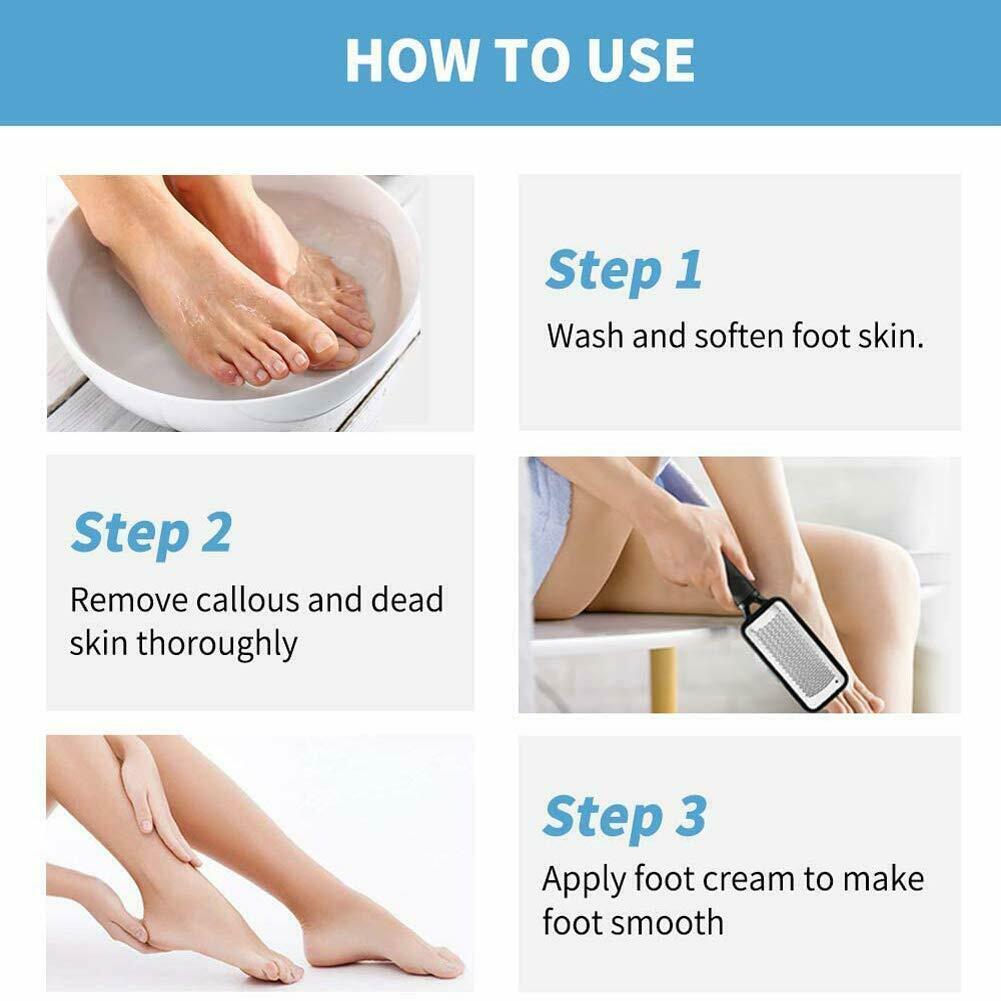 Foot Rasp File Callus Remover Pedicure Tool Dead Hard Skin Scraper Scrubber Tool - iztia